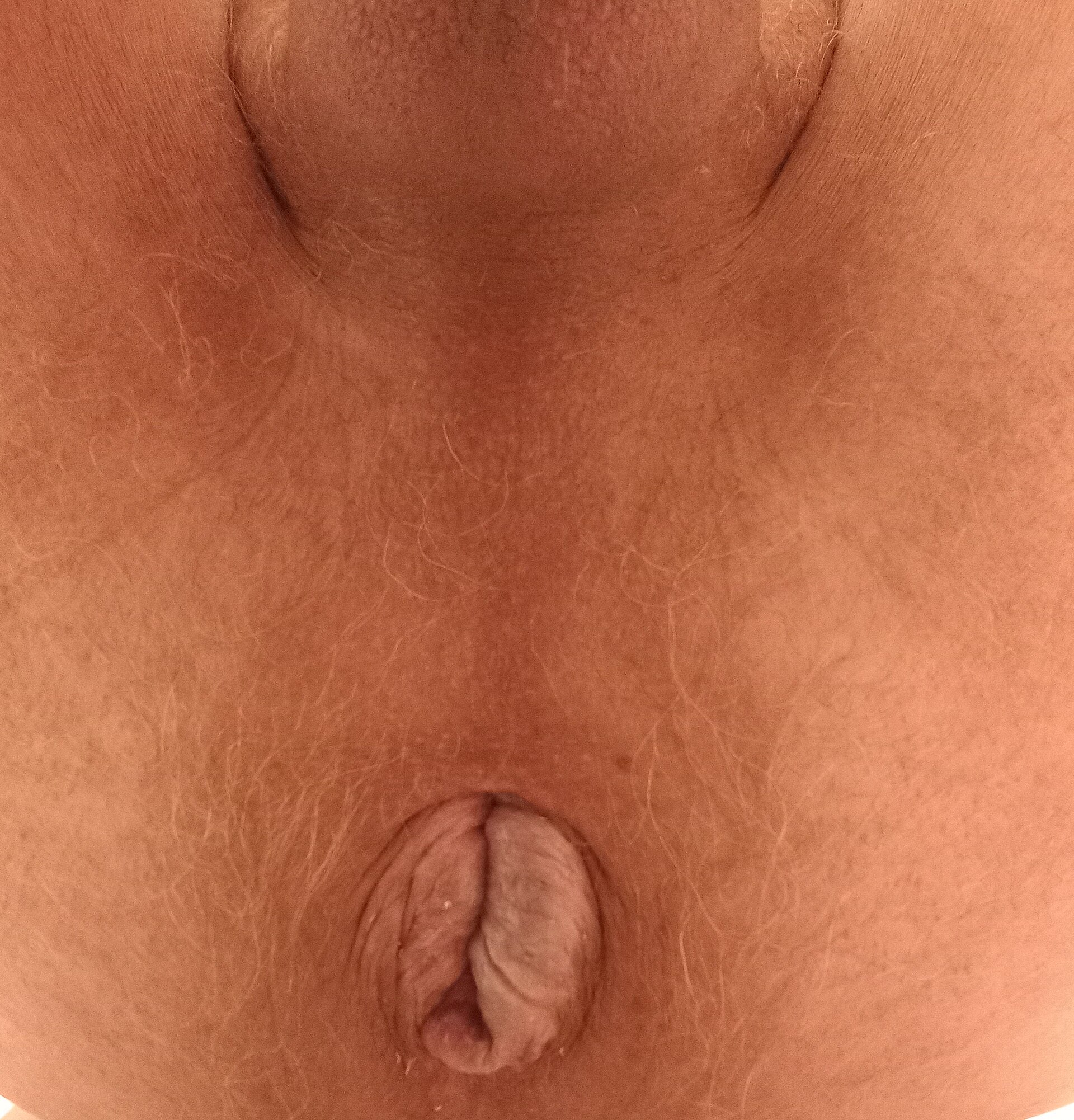 anal